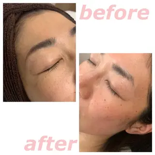 lafleur Yurinaのエステ・リラクイメージ