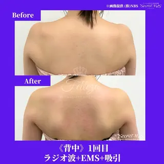 メンズ 有人型セルフサロン 脱毛/痩身/美顔のその他イメージ