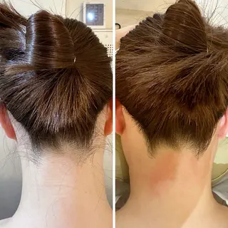 うなじ脱毛/美肌脱毛 LABELのエステ・リラクイメージ