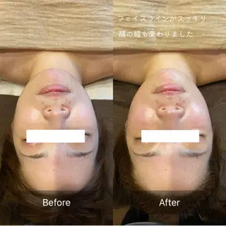 lumière d’espoirのエステ・リラクイメージ