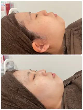 ELENA所属・津江 翔子のエステ・リラクイメージ