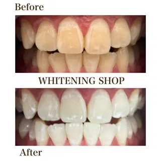 セルフホワイトニングショップ静岡葵区店所属・もえか静岡葵区店ホ ワイトニングショップのその他イメージ