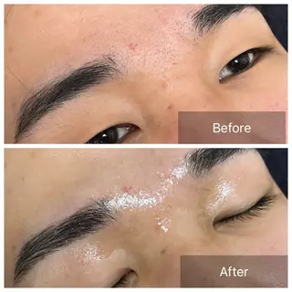 メンズ アイブロウ エマニエル USAのエステ・リラクイメージ