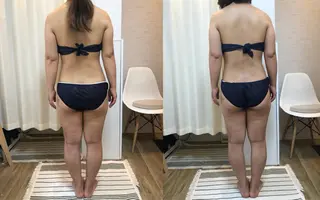 脱毛｜肌質改善｜ ROOM.Sのエステ・リラクイメージ