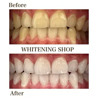 メンズ ホワイトニングショップ静岡葵区店所属・ホワイトニング ショップ静岡葵区店のその他イメージ