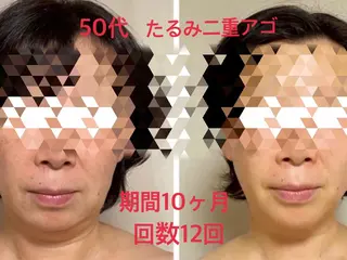 CHANCEシャンス HRMのエステ・リラクイメージ