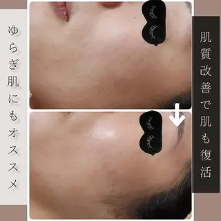 Glossy salonのエステ・リラクイメージ