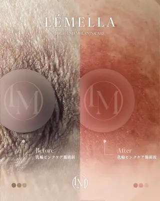 milimili所属・milimili salonのマツエク・マツパデザイン