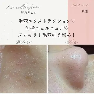 K's姪浜エステ💆 サロン:MAIKOのエステ・リラクイメージ