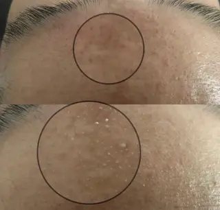 Angela エステサロンのマツエク・マツパデザイン