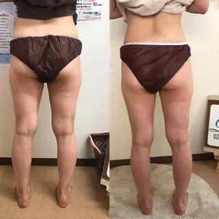 隠れ家サロンRocco所属・隠れ家サロン Roccoのエステ・リラクイメージ