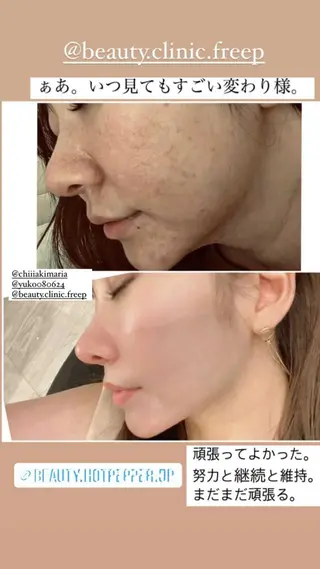 エステfreep takamoriのエステ・リラクイメージ