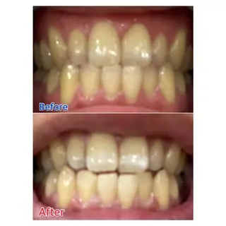 MBEAUTYSALON 千葉店・京成大久保所属・Melty 輝のその他イメージ