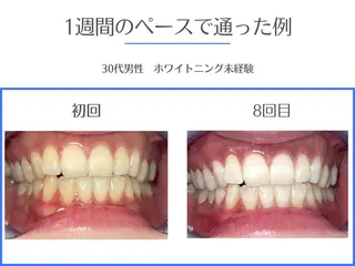 セルフホワイトニング エクシア岡崎店所属・ホワイトニング/脱毛 専門店エクシア岡崎店のその他イメージ