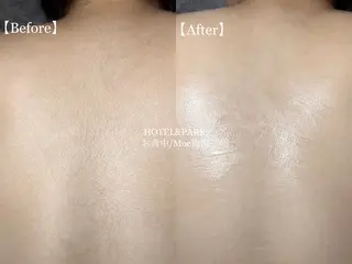 HOTEL&PARK . ワックス脱毛のエステ・リラクイメージ