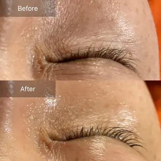 Mandarin Orange所属・毛穴から始める肌メン テマンダリンオレンジのエステ・リラクイメージ