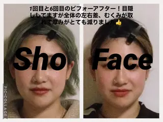 小顔矯正Sho  FaceDesignのエステ・リラクイメージ