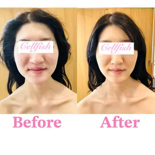 Cellfish ~セルフィッシュ~のエステ・リラクイメージ