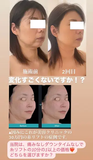 小顔/たるみ/黒ずみ除去専門サロン/SONA 大和西大寺店所属・【小顔専門看護師 サロンSONA】のエステ・リラクイメージ