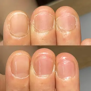 ネイル Aim* 深爪・自爪育成専門店のネイルデザイン