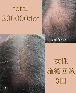 W eye+東口店/ SCALP INKのマツエク・マツパデザイン