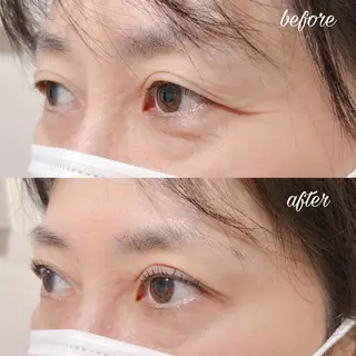 マツエク・マツパ merveilles所属・まつげ/整体/にきび ・アトピー専門サロンのマツエク・マツパデザイン