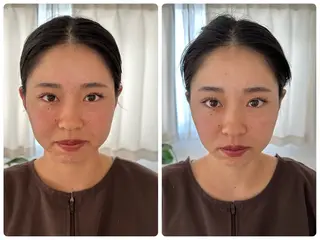 美容鍼＆鍼灸サロン 鍼Glitter.所属・田中 美奈のエステ・リラクイメージ