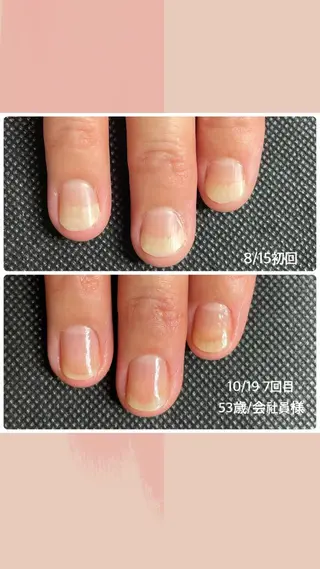 ネイル 奥園 良恵のネイルデザイン