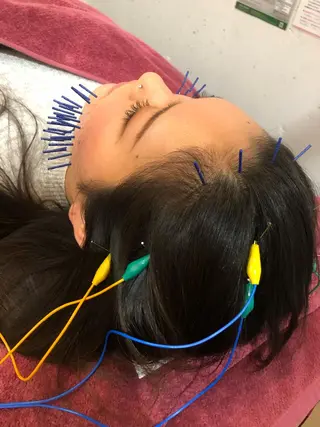 美容鍼灸女性専用 りんご鍼灸治療院のその他イメージ
