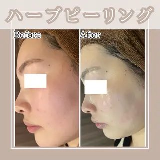 メンズ Amaryllis 🌹松本のエステ・リラクイメージ