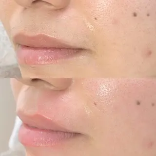 メンズ salonLADYSTYLE所属・稲嶺 美華のエステ・リラクイメージ