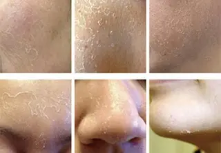 ☺ハーブピール💕 ソフィアカロン💖のエステ・リラクイメージ