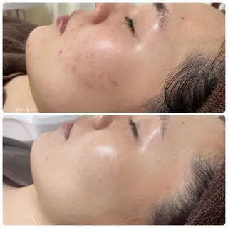 NiU.BEAUTY🥥池袋店所属・ハーブピーリング専門 NiU.BEAUTYのエステ・リラクイメージ