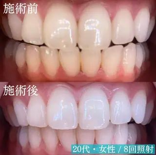 LBSホワイトニング上野店所属・LBSホワイトニング 🌐 上野店公式のエステ・リラクイメージ