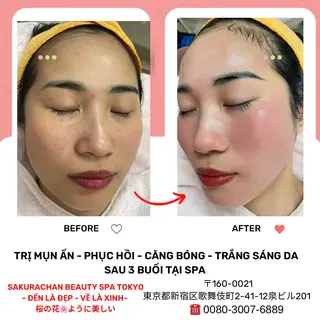 ニキビ、痩身、脱毛、 サクラチャンスパのエステ・リラクイメージ