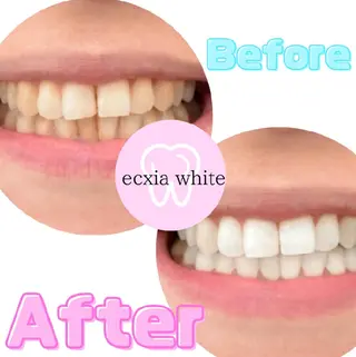 メンズ エクシアホワイトニング草津店所属・nanami -ホワイトニングのその他イメージ