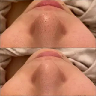 ✨美肌水光✨ アトリエリュバンのエステ・リラクイメージ