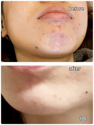 Beauty SalonAeriのエステ・リラクイメージ