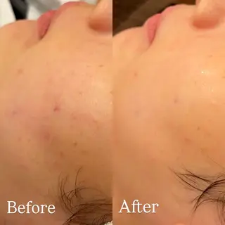 Hari Lounge恵比寿所属・chika🦋 ハリラウンジ恵比寿のエステ・リラクイメージ