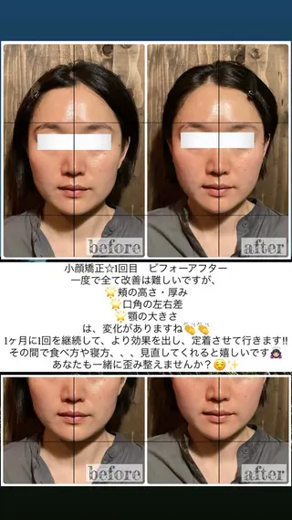 💎後悔させない小顔 矯正💎イトヤマ🌱のエステ・リラクイメージ