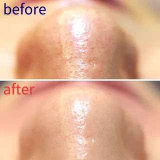 毛穴洗浄特化🫧 オオツカのエステ・リラクイメージ