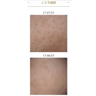 メナード瑞穂区平郷店 横山ともみのエステ・リラクイメージ