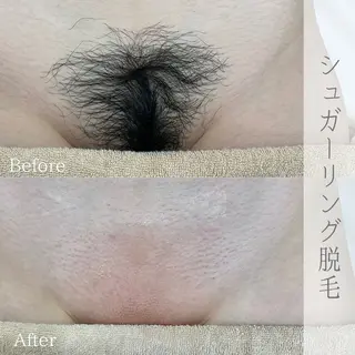 ciena KAYOのエステ・リラクイメージ