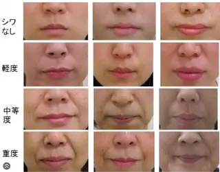 ☺ハーブピール💕 ソフィアカロン💖のエステ・リラクイメージ