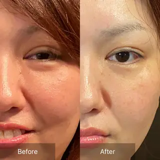 Mandarin Orange所属・毛穴から始める肌メン テマンダリンオレンジのエステ・リラクイメージ