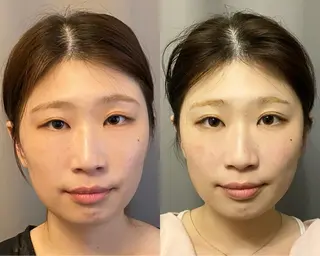 医療提携×美容整体 小顔ハイフピーリングのエステ・リラクイメージ