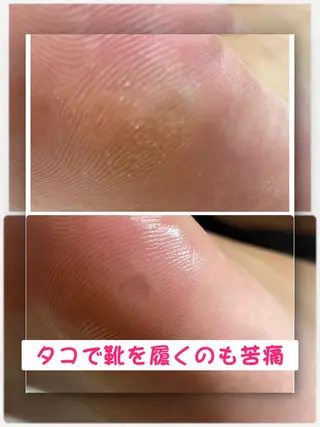 メンズ ネイル Chérinail 爪のお手入れのネイルデザイン