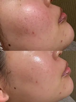 /ulu soin所属・太田 玲奈のエステ・リラクイメージ