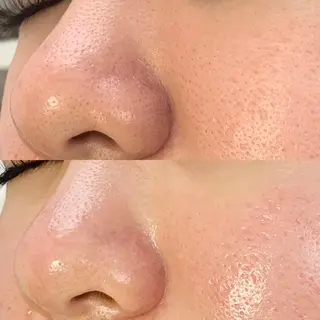 メンズ salonLADYSTYLE所属・稲嶺 美華のエステ・リラクイメージ