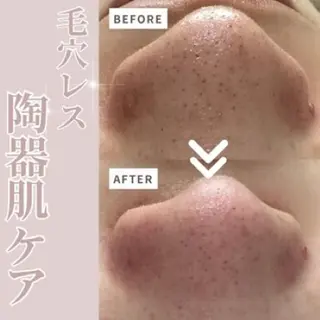 sii センター北 AIのエステ・リラクイメージ